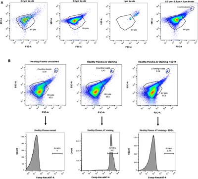 Complement C5a Induces Pro-inflammatory Microvesicle Shedding in <mark class="highlighted">Severely Injured</mark> Patients